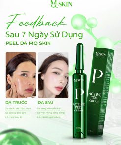 Phản hồi khách hàng peel da MQ Skin