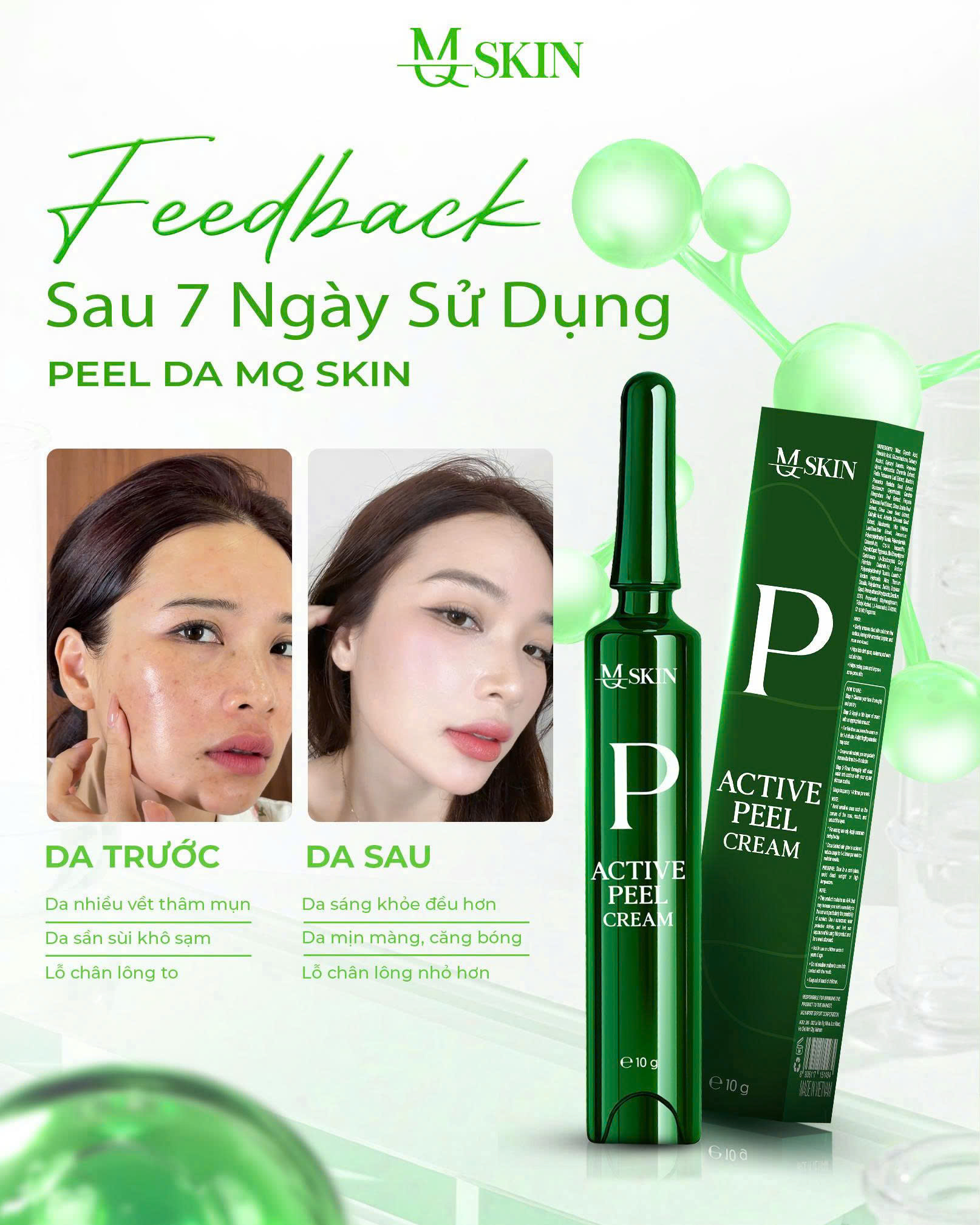peel da hiệu quả Phản hồi khách hàng peel da MQ Skin